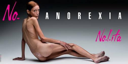 Oliviero Toscani - Anorexia